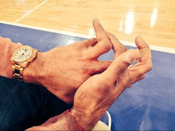Michael Strahan's hands are bad
